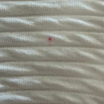 Cayma Hakkı İhlali Ve Kampanya Nedeniyle İade Reddi