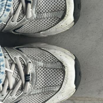 Ayakkabının Dikişleri Açıldı, Hızlı Değişim Ve İade Talebi