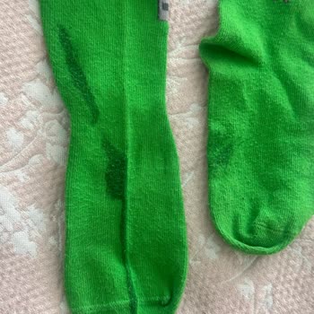 Kurutma Makinesi Çamaşırları Yaktı, Servis Yanıtsız