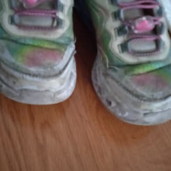 Skechers Ayakkabısında Açılma Ve Dikiş Sorunu; Mağaza Kullanıcı Hatası Dedi