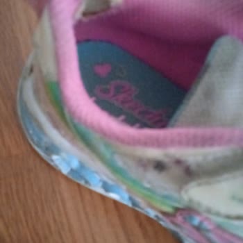 Skechers Ayakkabısında Açılma Ve Dikiş Sorunu; Mağaza Kullanıcı Hatası Dedi