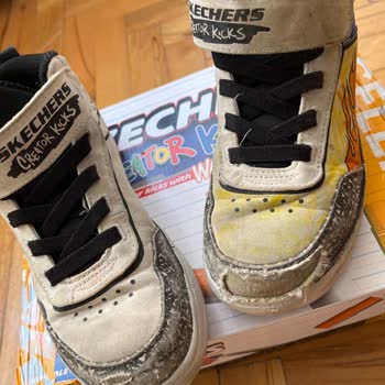 Skechers Çocuk Ayakkabısının Bir Ayda Yırtılması Ve Kullanıcı Hatası İddiası