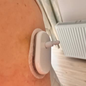 Sibionics Sensörümde Teknik Arıza Ve Müşteri Hizmetleri Tarafından Suçlayıcı Tutum