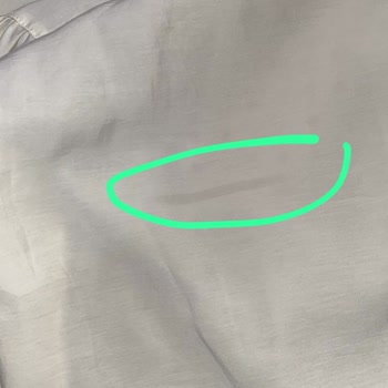 Kusurlu Ceket Ve Tüylenen Body İçin Hızlı İade Ve Değişim Talebi