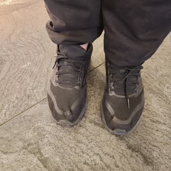 Deichmann Mağazasındaki Adidas Ayakkabının Ön Göçmesi Ve Reddedilen İade Talebi