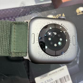 Vatan Bilgisayar Apple Watch Kısa Sürede Deforme Oldu, Ciltte Alerji Yarattı