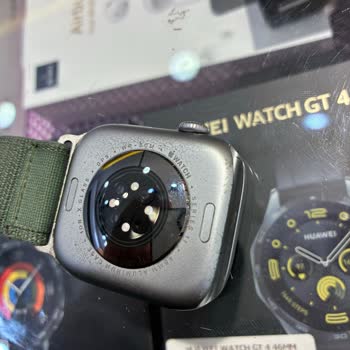 Apple Watch Deformasyonu Ve Sağlık Sorunu Nedeniyle Ücret İadesi Talebi