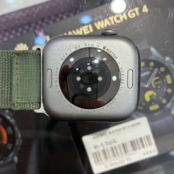 Apple Watch Deformasyonu Ve Sağlık Sorunu Nedeniyle Ücret İadesi Talebi