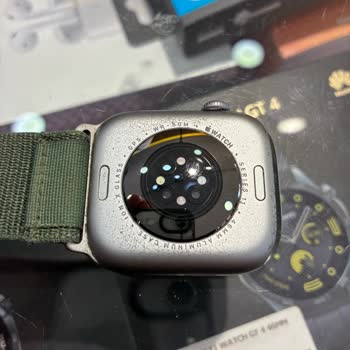 KVK Apple Watch Kasa Deformasyonu Ve Bilgilendirme Eksikliği Nedeniyle Ücret İadesi Talebi