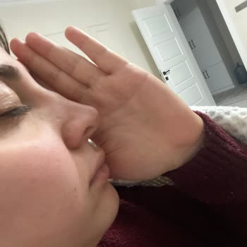 Rhinoplasti Sonrası Asimetrik Sonuç Ve Doktorun İlgisizliği