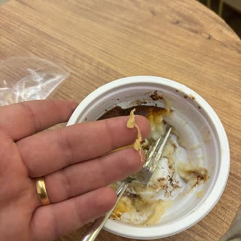 Migros Kazandibinde Hijyen Sorunu - Yabancı İplik Ve Müşteri Hizmetine Ulaşılamama