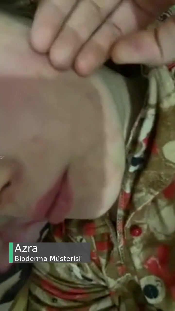 Bioderma Yüzümü Mahvetti! videonun kapak resmi