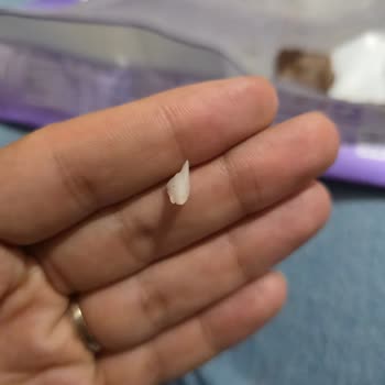 Milka Çikolatasında Çıkan Sert Cisim Çocuk Sağlığını Tehdit Ediyor