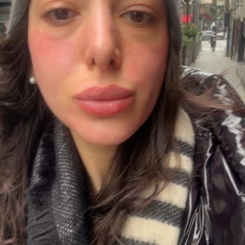 Aika Nişantaşı Beauty’de Cilt Bakımı Ve Manikürde Ağır İhmal Ve Yanıltıcı Fiyatlandırma