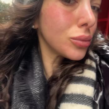 Aika Nişantaşı Beauty’de Cilt Bakımı Ve Manikürde Ağır İhmal Ve Yanıltıcı Fiyatlandırma