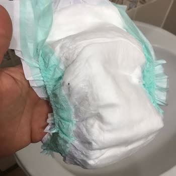 Bebek Bezinde Çivi Benzeri Metal Parça Tespit Edildi