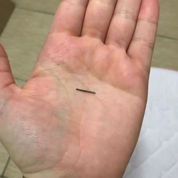 Bebek Bezinde Çivi Benzeri Metal Parça Tespit Edildi