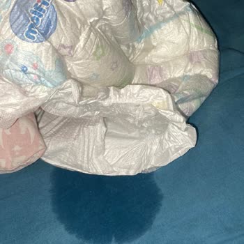 Molfix Bebek Bezinde Sürekli Sızdırma Ve Değişim Talebi