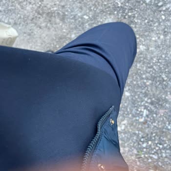 Kalitesiz Pantolon Renk Atesi Ve Dikiş Sorunu İade Talebi