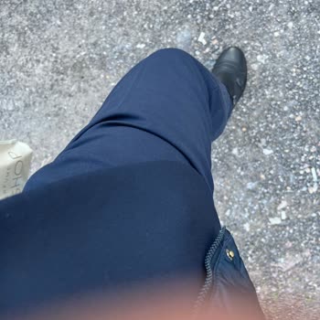 Kalitesiz Pantolon Renk Atesi Ve Dikiş Sorunu İade Talebi