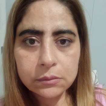 Heaven Deluxe Uşak’ta Kaş Laminasyonu Sonrası Siyah Kaşlar Ve İade Talebi