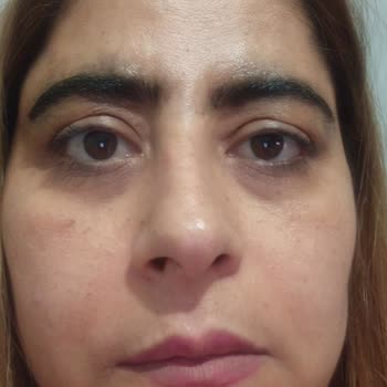 Heaven Deluxe Uşak’ta Kaş Laminasyonu Sonrası Siyah Kaşlar Ve İade Talebi