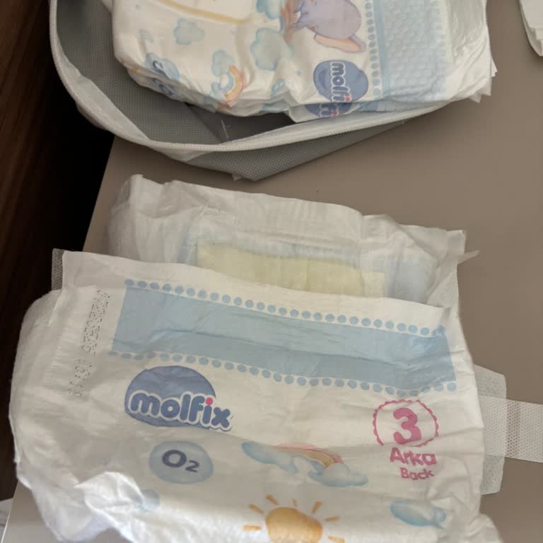 Molfix Premium Smart Fit Bebekte Sürekli Sızma Ve Yoğun Koku Şikayeti