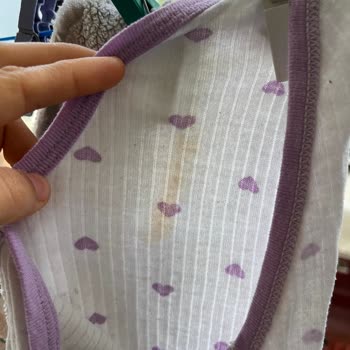 Arçelik 10120 Çamaşır Makinesinde Aşırı Ses, Servis Reddetmesi Ve Değişim İsteği