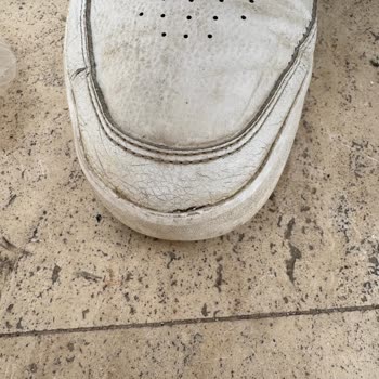 Adidas Ayakkabıda Kısa Sürede Açılan Yanlar Ve Değişim Reddi