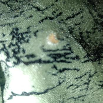 Defolu Koltuk Örtüsü Ve Açıklama Yok Reddedilen İade Talebi