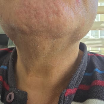 Media Markt’tan Aldığım Babyliss Tıraş Makinesi Cildi Tahriş Ediyor, İade Reddi