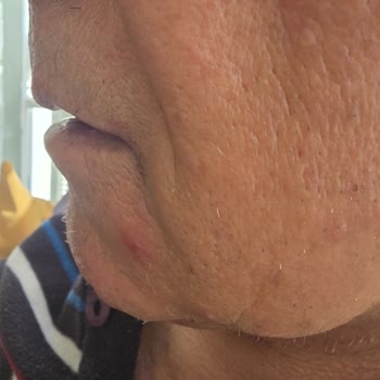 Media Markt’tan Aldığım Babyliss Tıraş Makinesi Cildi Tahriş Ediyor, İade Reddi