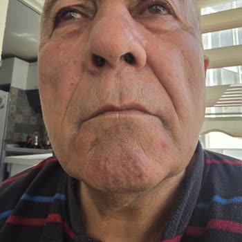 Media Markt’tan Aldığım Babyliss Tıraş Makinesi Cildi Tahriş Ediyor, İade Reddi