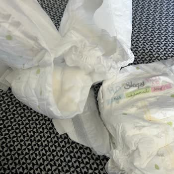 BİM'den Aldığım Sleepy Natural Bebek Bezleri Sürekli Yırtılıyor, Kalite Sorunu