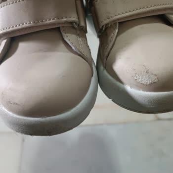 Vicco Çocuk Ayakkabısının Deri Çatlaması Ve Mağaza Çalışanlarının İlgisiz Yaklaşımı