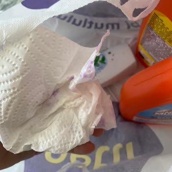 Siparişte Kimyasal Dökülme Ve Sistem Hataları Güvenimi Yıktı