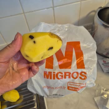 Migros'tan Patatesler Sürekli Çürük Çıkıyor