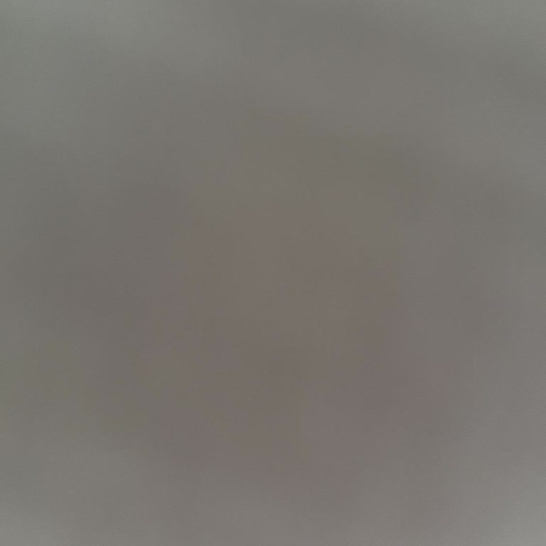 İkinci Doz Botoks Randevusu İçin Verilen Sözlerin Tutulmaması