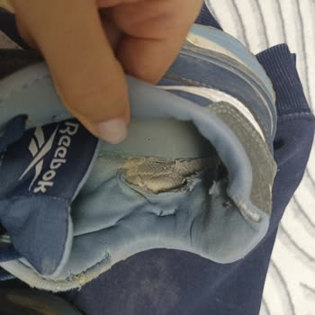 Reebok Ayakkabısının İç Astarı Yırtıldı, Kullanıcı Hatası İddiası Kabul Edilemez
