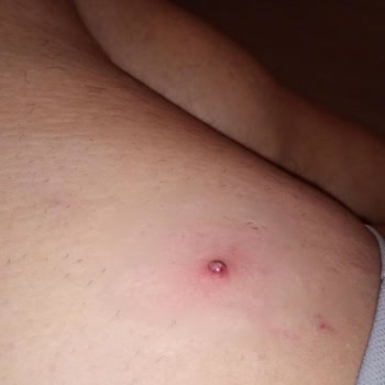 Axa Oyak’ten Açıklama Almadan Tedavi Reddi, İletişimsizlik Ve Mağduriyet