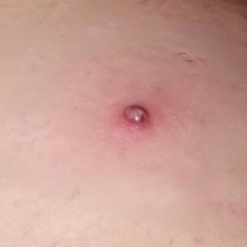 Axa Oyak’ten Açıklama Almadan Tedavi Reddi, İletişimsizlik Ve Mağduriyet