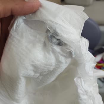 Molfix Bebek Bezinde Sert Taş Parçaları Bulundu, Güvenlik Endişesi