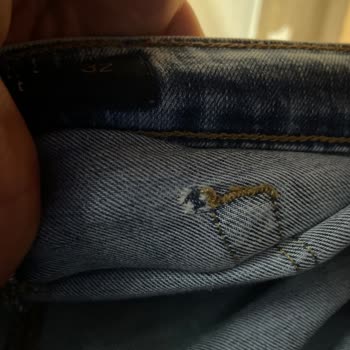 Lufian Kotta Arka Cep Yırtılması Tekrarlandı