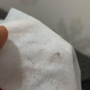 Molfix Islak Mendil İçinde Bulunan Sivri Demir Parçası Bebeği Tehlikeye Atıyor
