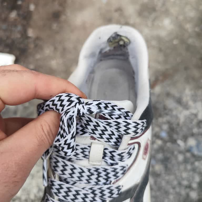 In Street Topuk Plastikleri Nedeniyle Sürekli Yara Açan Müşteri Çözüm Bekliyor