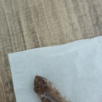 Torku Kekinde Plastik Parça: Sağlık Riski Ve İade Talebi