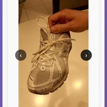New Balance Ayakkabısının Hızlı Sararması Ve Ret Kararı Kabul Edilemez