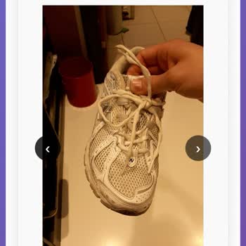 New Balance Ayakkabısının Hızlı Sararması Ve Ret Kararı Kabul Edilemez
