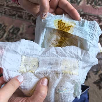 Prima Premium Care 2 Numaralı Bezlerde Sızdırma Ve Ücret İadesi Talebi