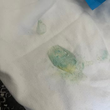 Peros Kapsül Deterjanı Kot Pantolonu Mahvetti: Ürün Hatası Ve Tazminat Talebi